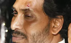 Andhra Pradesh CM injured as stone hurled at him in Vijayawada