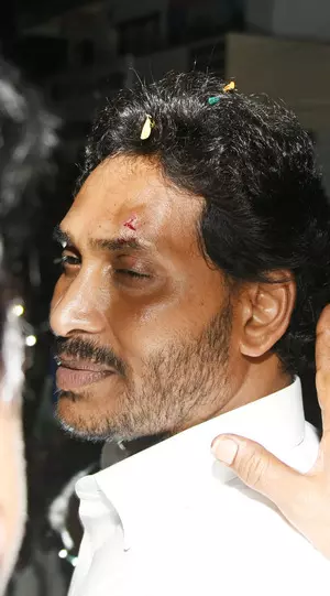 Andhra Pradesh CM injured as stone hurled at him in Vijayawada