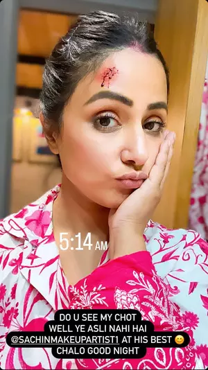 Hina Khan offers glimpses of night shoot, flaunts her ‘chot’: ‘Yeh asli nahi hai’ Hina Khan offers glimpses of night shoot, flaunts her ‘chot’: ‘Yeh asli nahi hai’