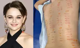 Joey King shares results of allergy test, says shes pretty much allergic to everything