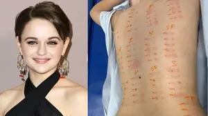 Joey King shares results of allergy test, says shes pretty much allergic to everything