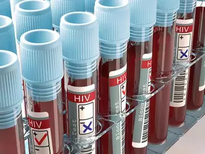 Philippines tallies 55 new HIV cases daily