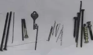 Nails, needles, nuts and bolts removed from mans stomach in Jaipur