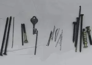 Nails, needles, nuts and bolts removed from mans stomach in Jaipur