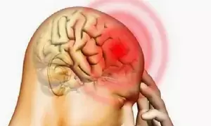 2 die of suspected meningococcal meningitis disease in Vietnam