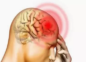 2 die of suspected meningococcal meningitis disease in Vietnam