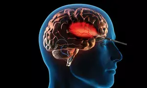 Lucknow hospital surgically treats ‘suicide disease’