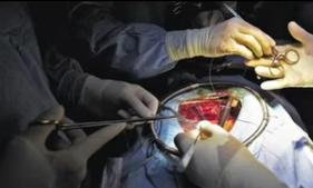 Doctors remove giant abdominal tumour bigger than a football weighing  7.5 kg