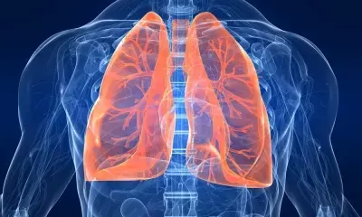 Why are most lung cancer patients in India non-smokers?