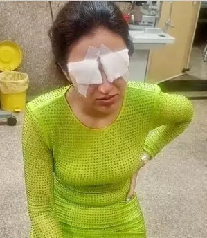 Know what is corneal damage that affected Jasmine Bhasin Know what is corneal damage that affected Jasmine Bhasin