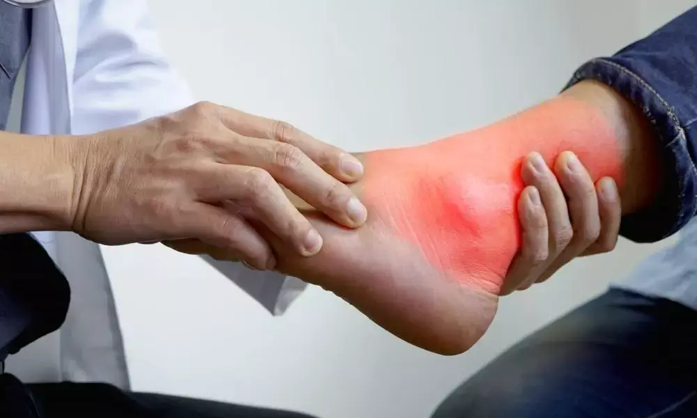 Natural Remedies to Control High Uric Acid: Beetroot, Coffee, Papaya, and Orange Juice