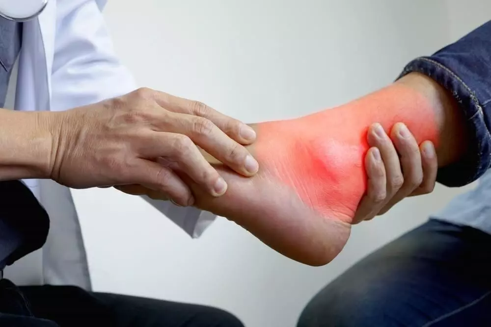 Natural Remedies to Control High Uric Acid: Beetroot, Coffee, Papaya, and Orange Juice Natural Remedies to Control High Uric Acid: Beetroot, Coffee, Papaya, and Orange Juice