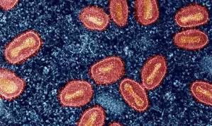 AIIMS Delhi issues protocol for handling patients with suspected monkeypox