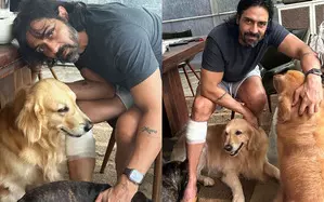 Arjun Rampal shares a glimpse of ‘love bite’ from pet dog Arjun Rampal shares a glimpse of ‘love bite’ from pet dog