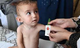 Afghanistan: 26 children die of malnutrition in Badakhshan