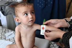 Afghanistan: 26 children die of malnutrition in Badakhshan