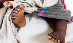 Four Botswanan children die from diarrhoea in August