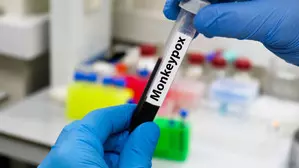 Democratic Republic of the Congo allocates $10 mn to fight mpox: President Democratic Republic of the Congo allocates $10 mn to fight mpox: President