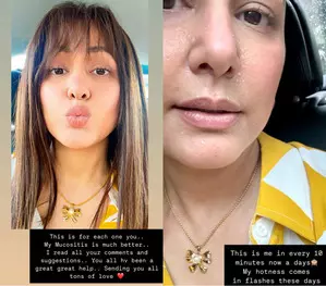 Hina Khan shares a big update on her fight against mucositis