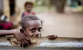 25 per cent of Guinean children under five suffer from severe chronic malnutrition