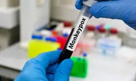 Philippines detects 3 more Mpox cases