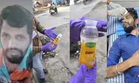 Bluru man suffers burn injuries after bathroom cleaner hurled, police hunt for accused