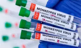 WHO donates 5,000 mpox sample collection kits to Uganda