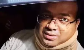 Lapses in autopsy report: RG Kar doctor at CBI office for interrogation