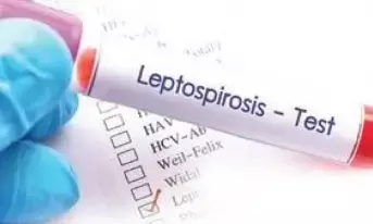 What is extremely rare Leptospirosis which affected Punjab CM