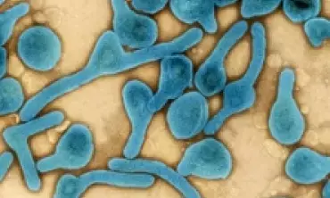 Rwanda records seven more Marburg virus disease cases