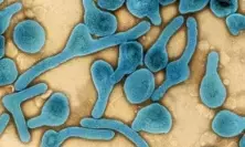 Kenya issues alert on spread of Marburg virus disease