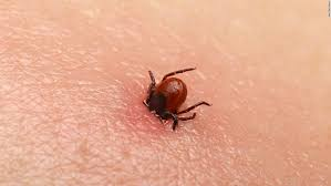 Woman dies of congo fever in Jodhpur