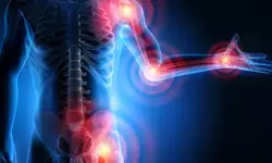 Increased understanding of arthritis helps overcome complications, say doctors