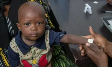 Authorities issue alert on measles outbreak in Malawian capital