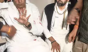 ‘Stone me or shoot me, won’t spare anyone,’ says Anil Deshmukh after discharge (Lead)