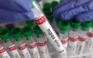 Kenya urges strict adherence to mpox preventive measures amid rising cases