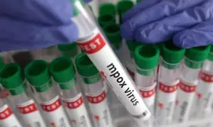 Kenya urges strict adherence to mpox preventive measures amid rising cases