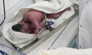 Woman gives birth to child at makeshift hospital in UPs Mahakumbh Nagar