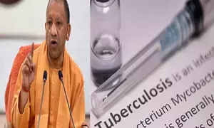 Retired IAS, IPS officers and ex VCs unite as Nikshay Mitras to  champion TB-free Uttar Pradesh