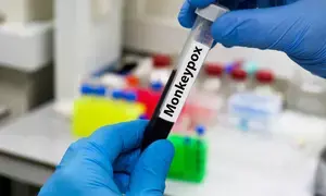 Zambia reports fourth monkeypox case