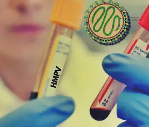 Maha govt sets up Task Force after two HMPV cases in Nagpur Maha govt sets up Task Force after two HMPV cases in Nagpur