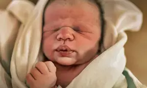 Medical leader urges caution amid reports of Indians seeking early C-Sections to beat Trump citizenship order