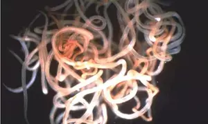 Niger becomes first African country to eliminate onchocerciasis