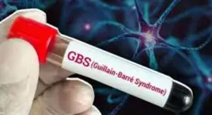 GBS outbreak: Centre asks Maha govt to step up monitoring and implement adequate measures