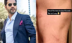 Varun Dhawan showcases ‘few of the many bruises’ he sustained