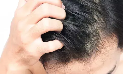 Get rid of hair fall: Include these 5 things in your diet for healthy and thick hair