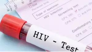 HIV/AIDS prevalence rate in Senegal stands at 0.3 pc HIV/AIDS prevalence rate in Senegal stands at 0.3 pc