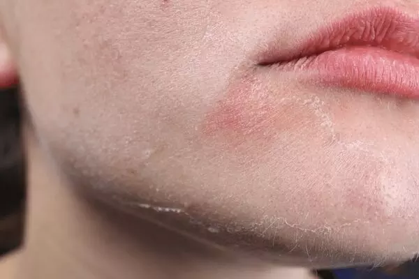 Skincare alert for dry skin people: Avoid using these things Skincare alert for dry skin people: Avoid using these things