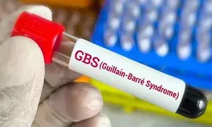 Andhra Pradesh reports another death due to GBS