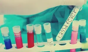 Nigeria reports 80 deaths in Lassa fever outbreak